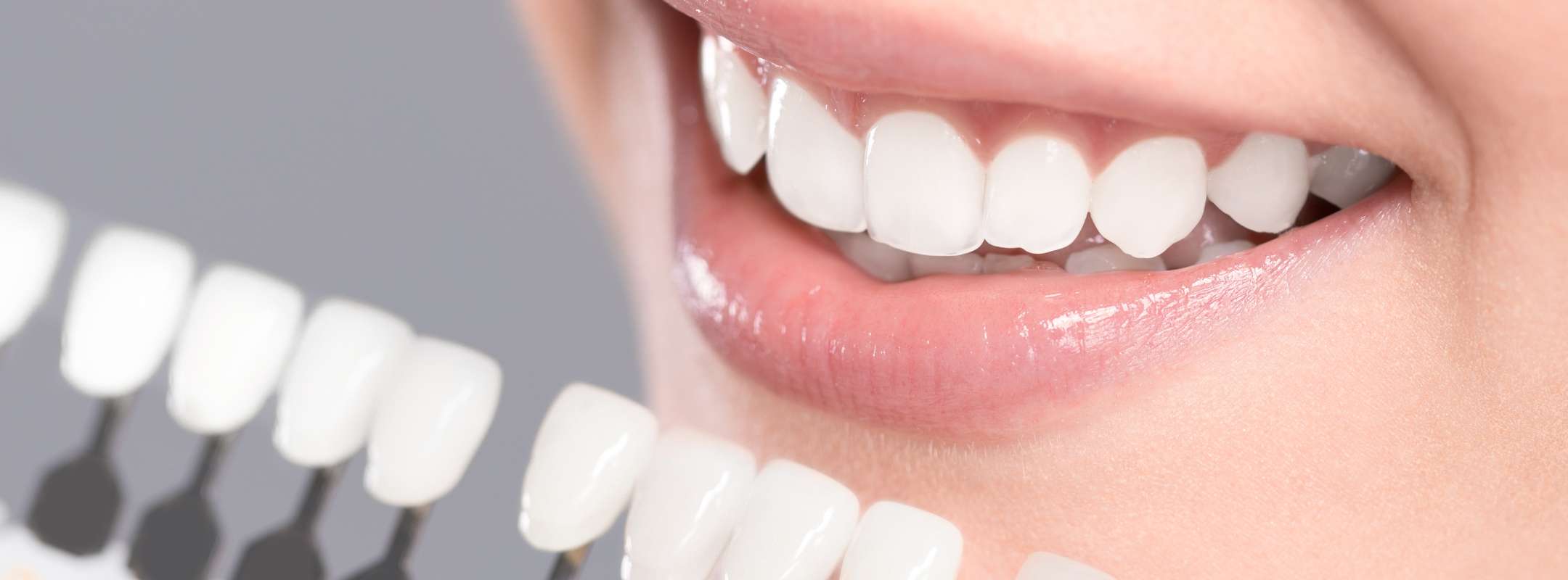 歯を白くするホワイトニング