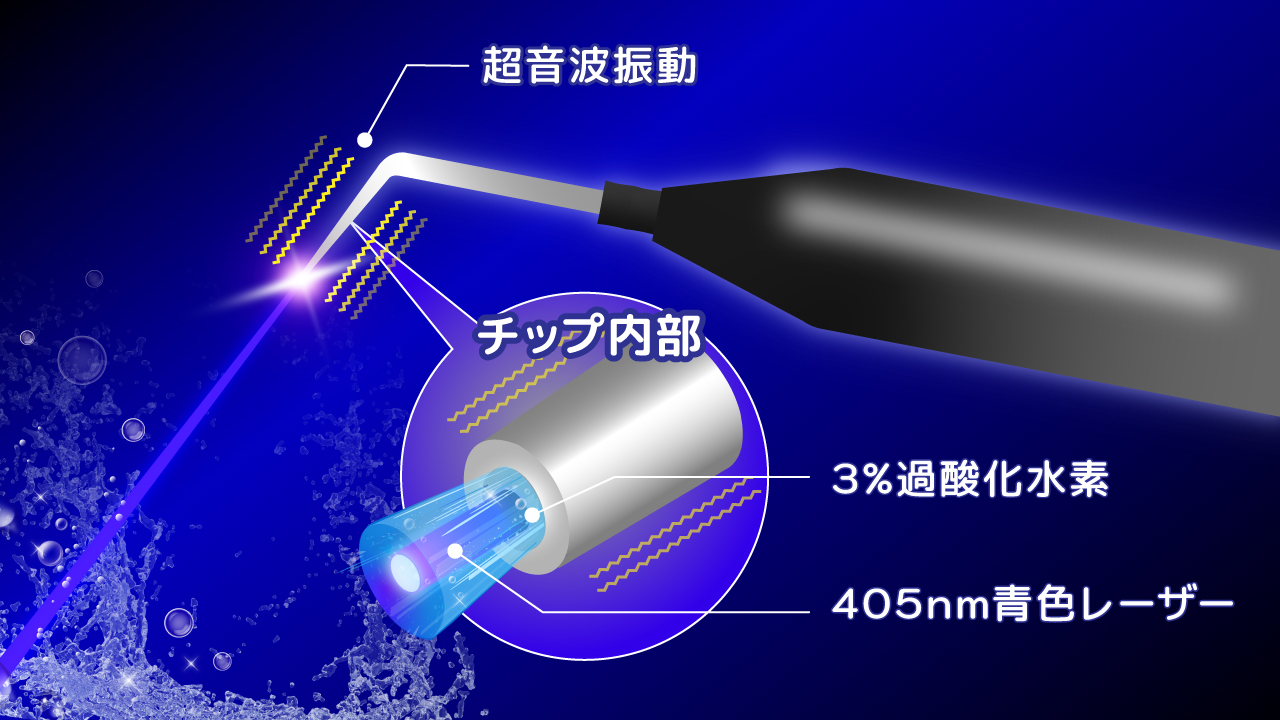 手術なしで殺菌可能