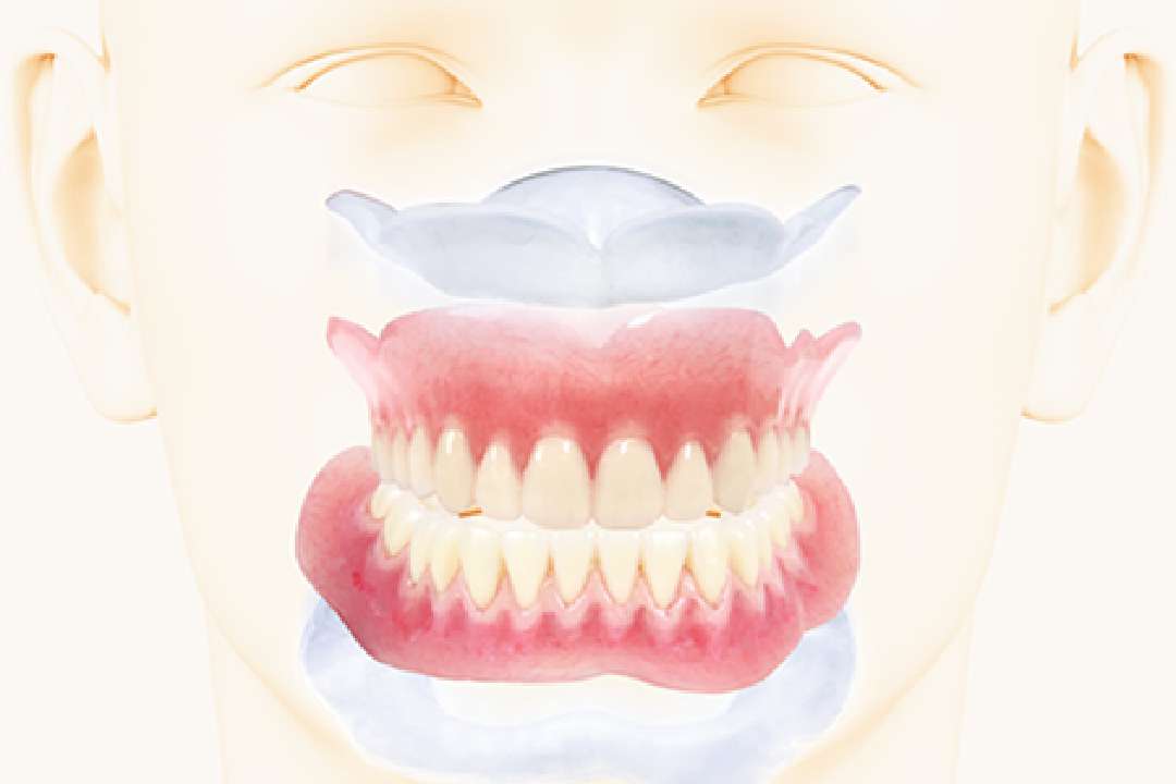 お口の粘膜にぴったりとフィットするコンフォート義歯